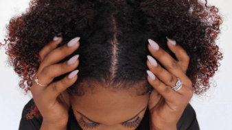 Femme cheveux frisés cuir chevelu