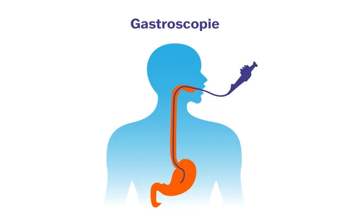 Gastroscopie 