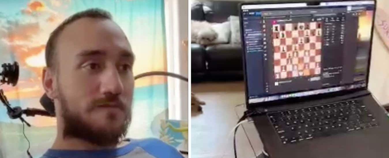 Neuralink: Has Elon Musk made a breakthrough in brain implant technology?