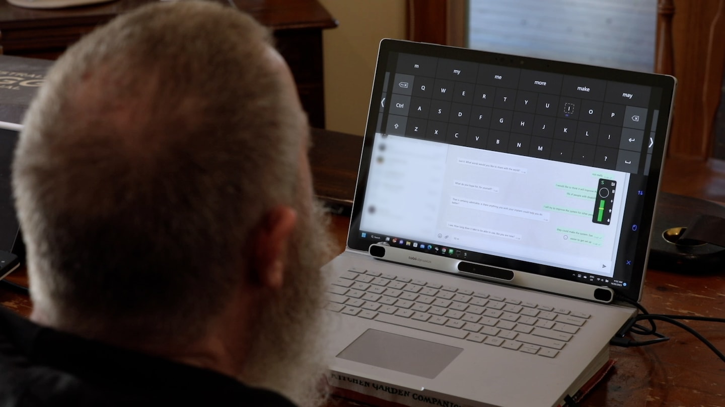 The race to beat Elon Musk's Neuralink and put chips in people's brains