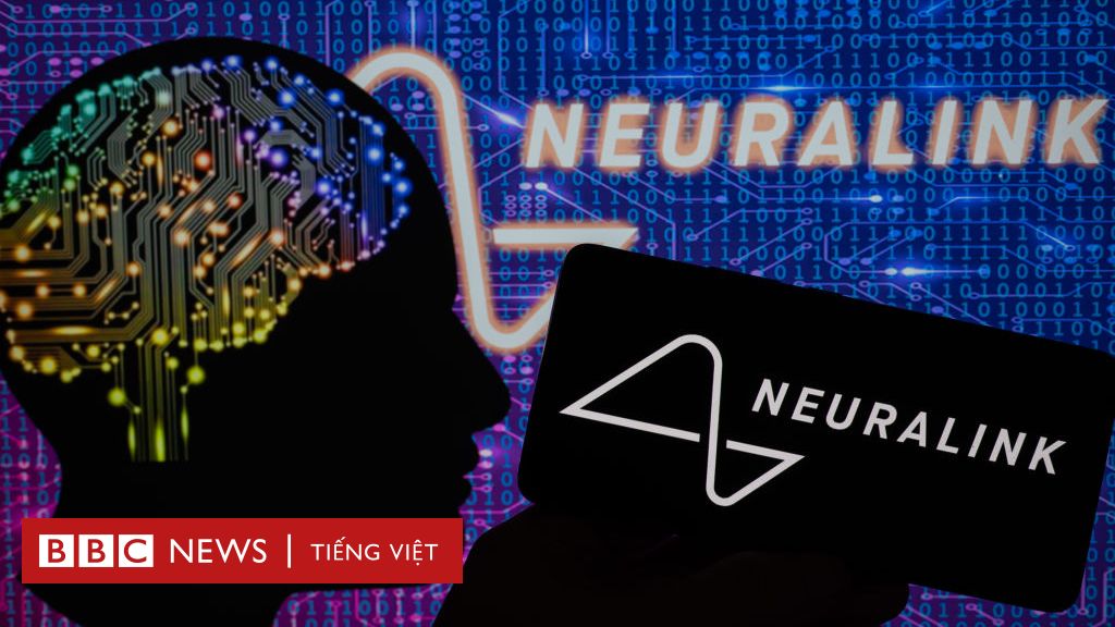 Neuralink: Công ty gắn chip trong não người của Elon Musk và lo ngại về mặt đạo đức