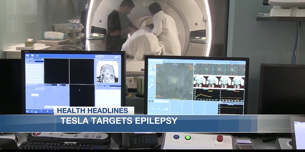 Health Headlines: Tesla targets epilepsy