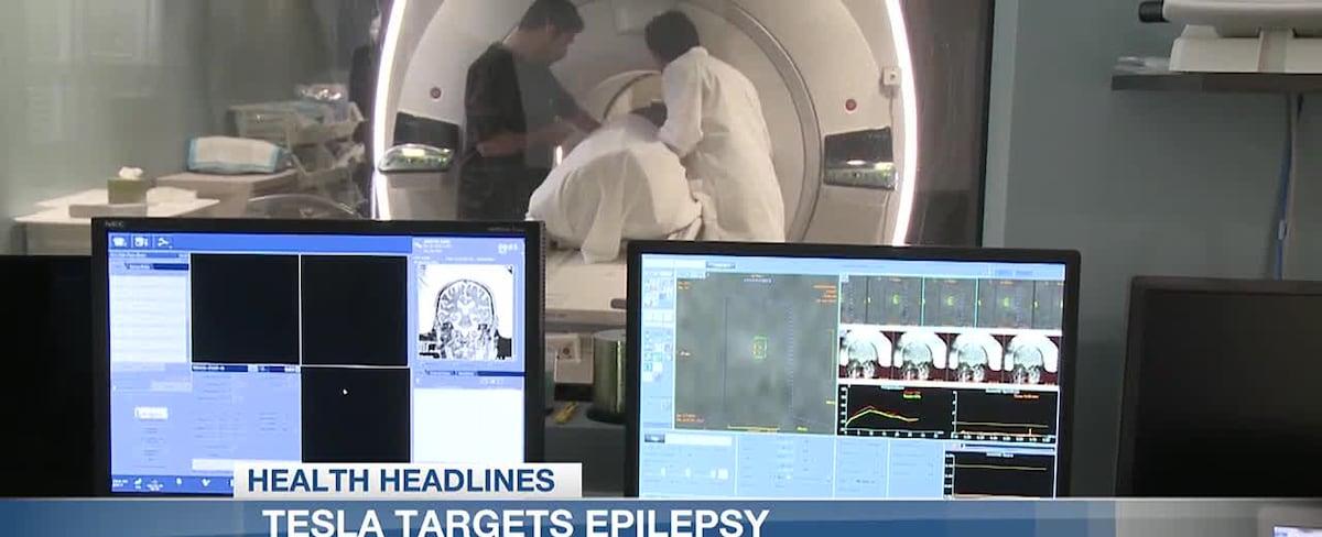 Health Headlines: Tesla targets epilepsy