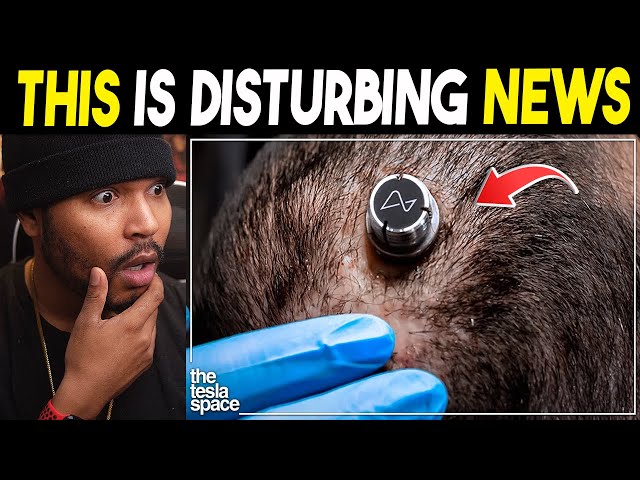 Elon Musk Neuralink Begins First Human Experiments!