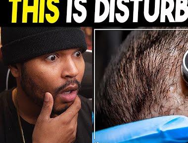 Elon Musk Neuralink Begins First Human Experiments!