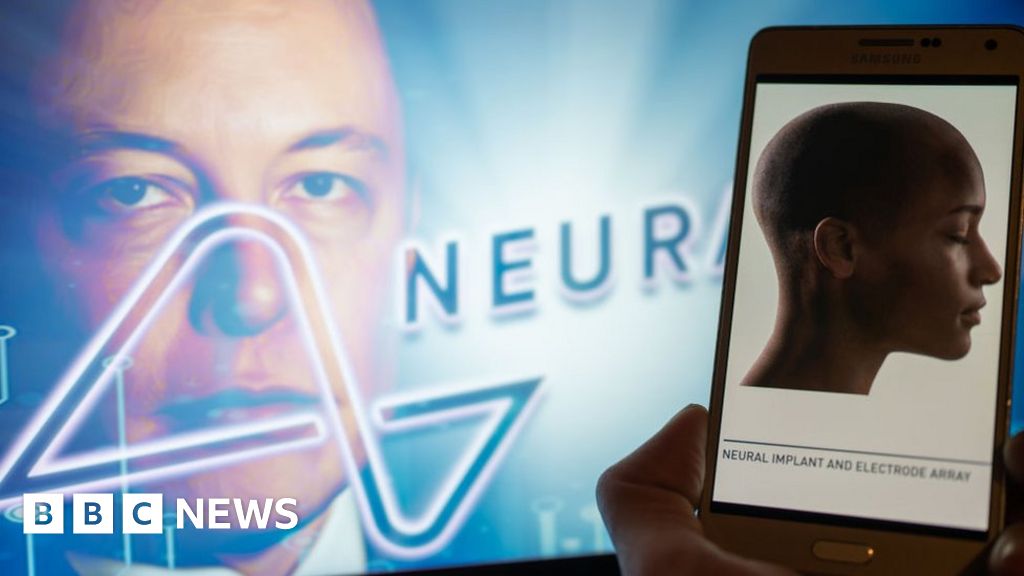 Elon Musk announces first Neuralink wireless brain chip implant