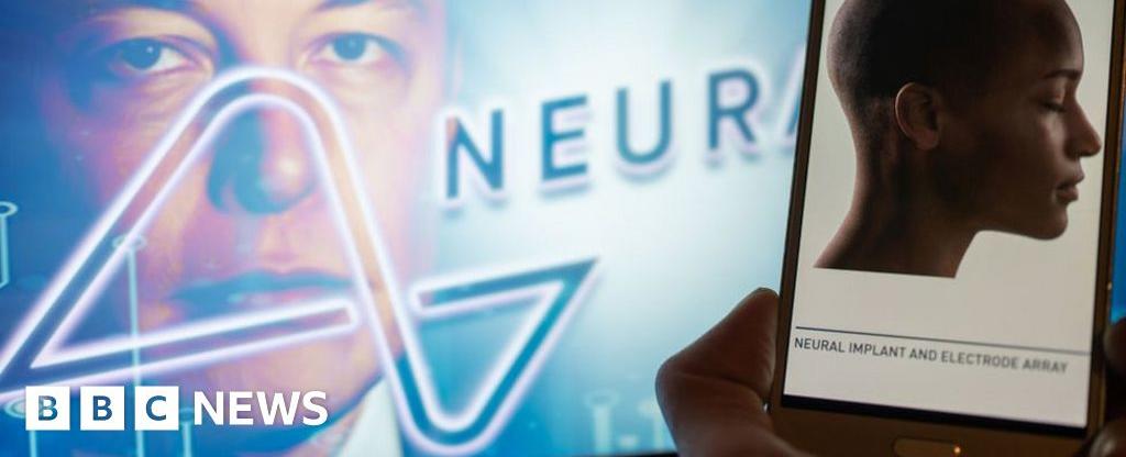 Elon Musk announces first Neuralink wireless brain chip implant