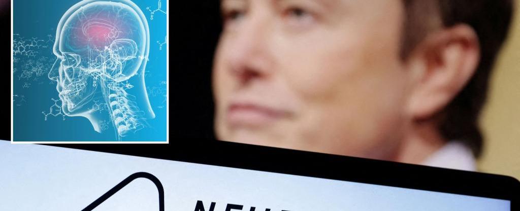 Elon Musk's Neuralink gets FDA approval for human test of brain implants