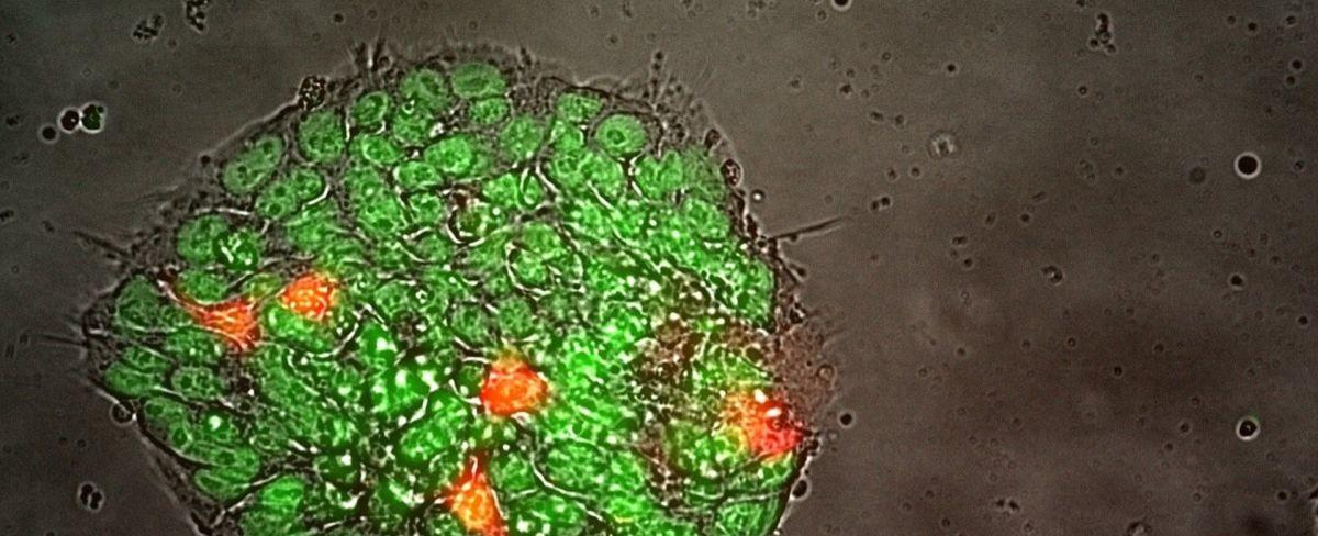 SpaceX Ax-2 astronaut mission will grow 1st stem cells in space