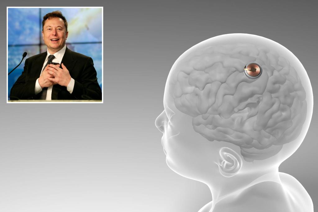 Elon Musk's Neuralink looking for volunteer to have skull cut open