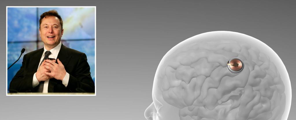 Elon Musk's Neuralink looking for volunteer to have skull cut open