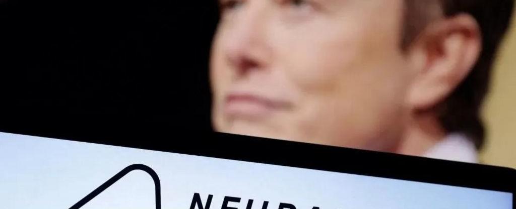 Neuralink: Marekani yaidhinisha kampuni ya Elon Musk kufanya utafiti kwa binadamu ili kutengeneza chipu za ubongo - BBC News Swahili