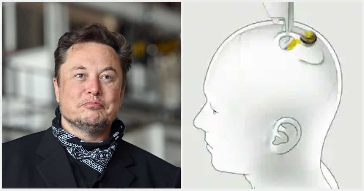 Elon Musk's Neuralink Gets Govt Approval to Implant Microchips in Human Brains, Releases Video