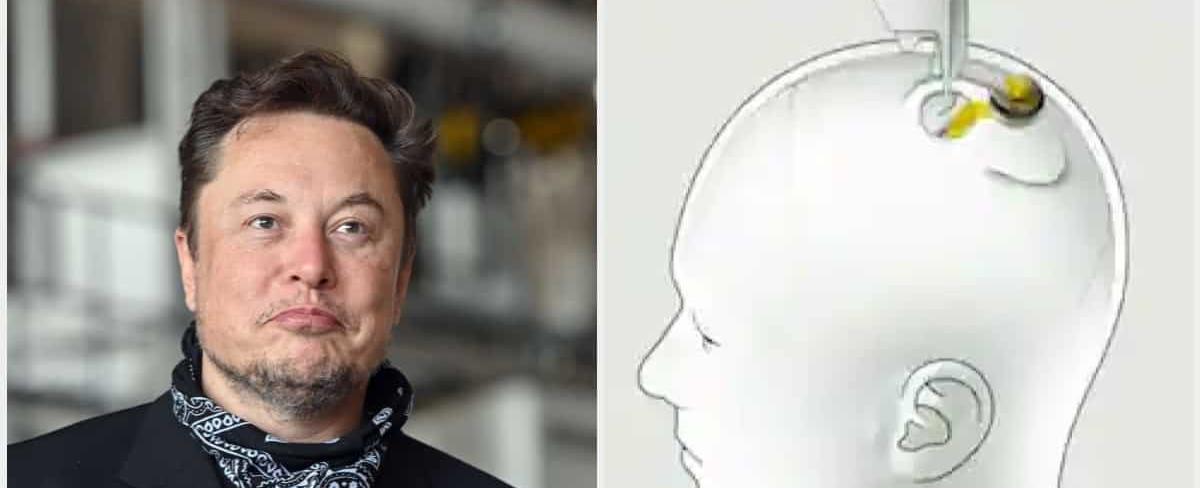 Elon Musk's Neuralink Gets Govt Approval to Implant Microchips in Human Brains, Releases Video
