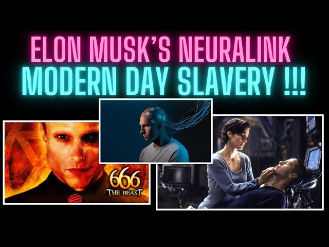 ELON MUSK IMPLANTED NEURALINK BRAINCHIP IN FIRST HUMAN | Almas Jacob