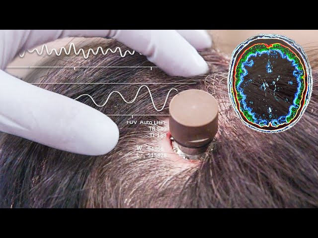 Message To Elon Musk, Neuralink Implant, FDA Approval 5/25/2023