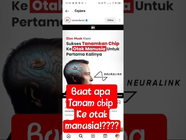 neuralink Elon musk buat apa tanam chip ke otak manusia