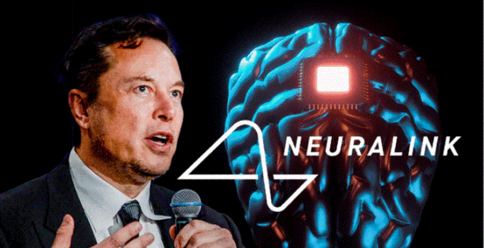 Neuralink, de Elon Musk, recibe la aprobación de la FDA para estudiar implantes cerebrales en humanos