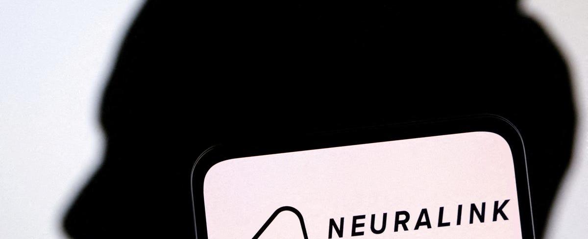 Neuralink de Elon Musk y sus principales rivales en chips cerebrales