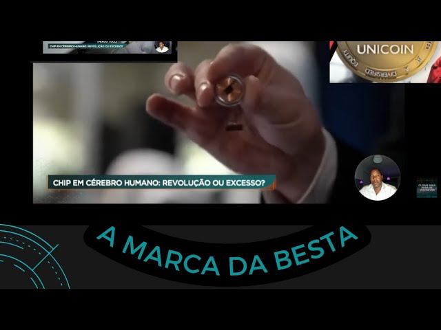 N1 CHIPE EM CÉREBRO HUMANO: Neuralink é aposta de Elon Musk