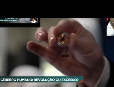 N1 CHIPE EM CÉREBRO HUMANO: Neuralink é aposta de Elon Musk