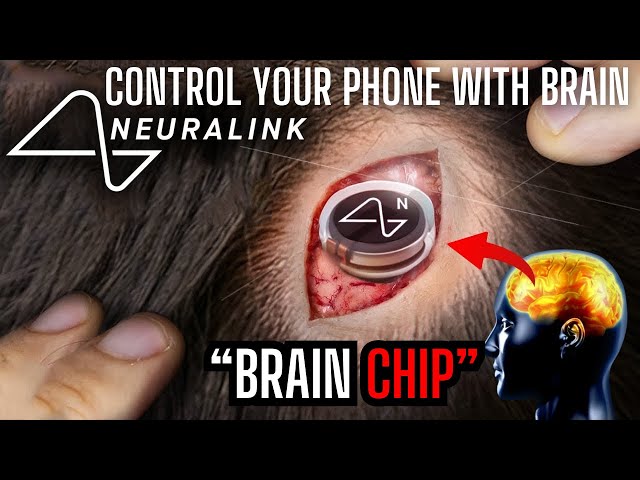 Elon Musk Begins First Human Experiments! [Brain Chip] Neuralink