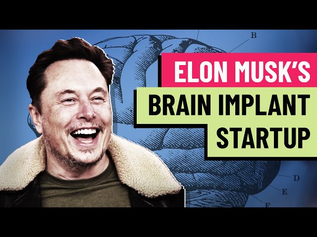 Should Elon Musk be trusted with human brains? Neurologist weighs in on Neuralink