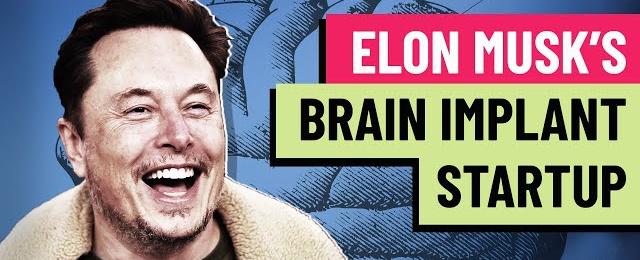 Should Elon Musk be trusted with human brains? Neurologist weighs in on Neuralink