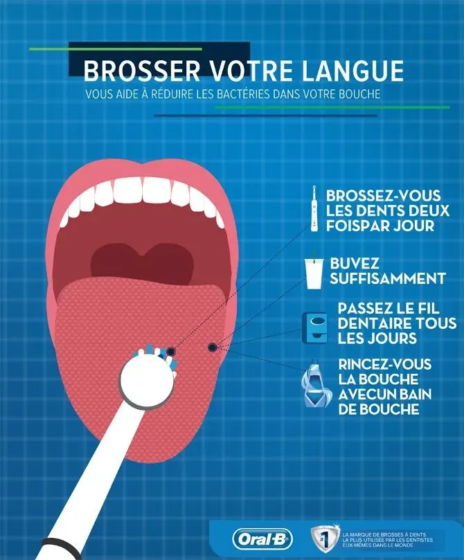 Se débarrasser des causes de la mauvaise haleine (halitose)