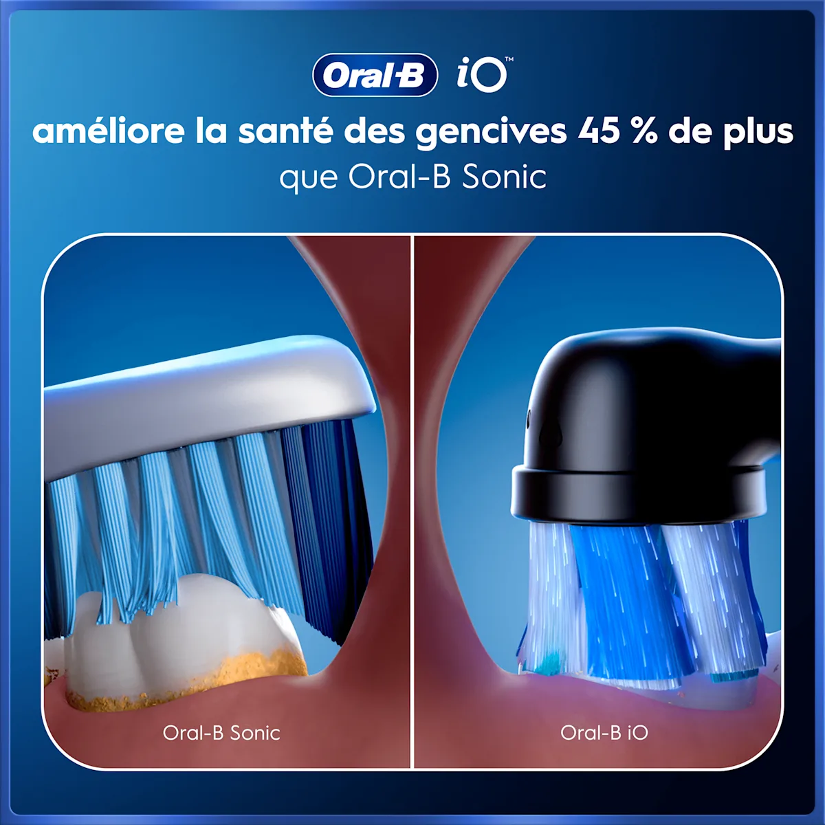 Oral-B iO améliore la santé des gencives 45% de plus que Oral-B Sonic.