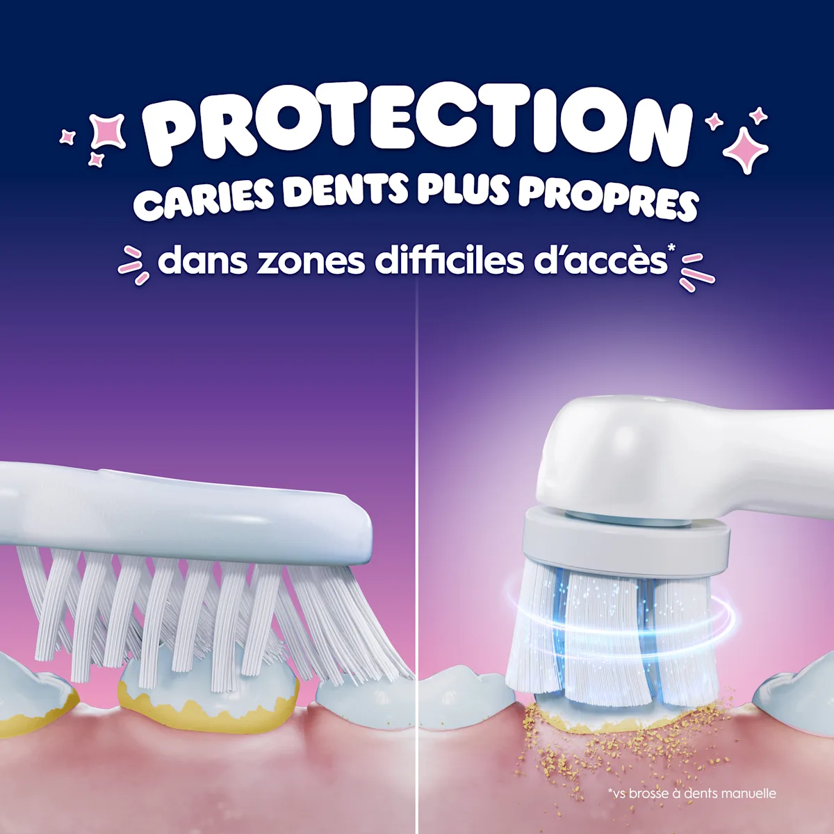 Comparaison de brosses à dents montrant une meilleure protection contre les caries en zones difficiles d’accès