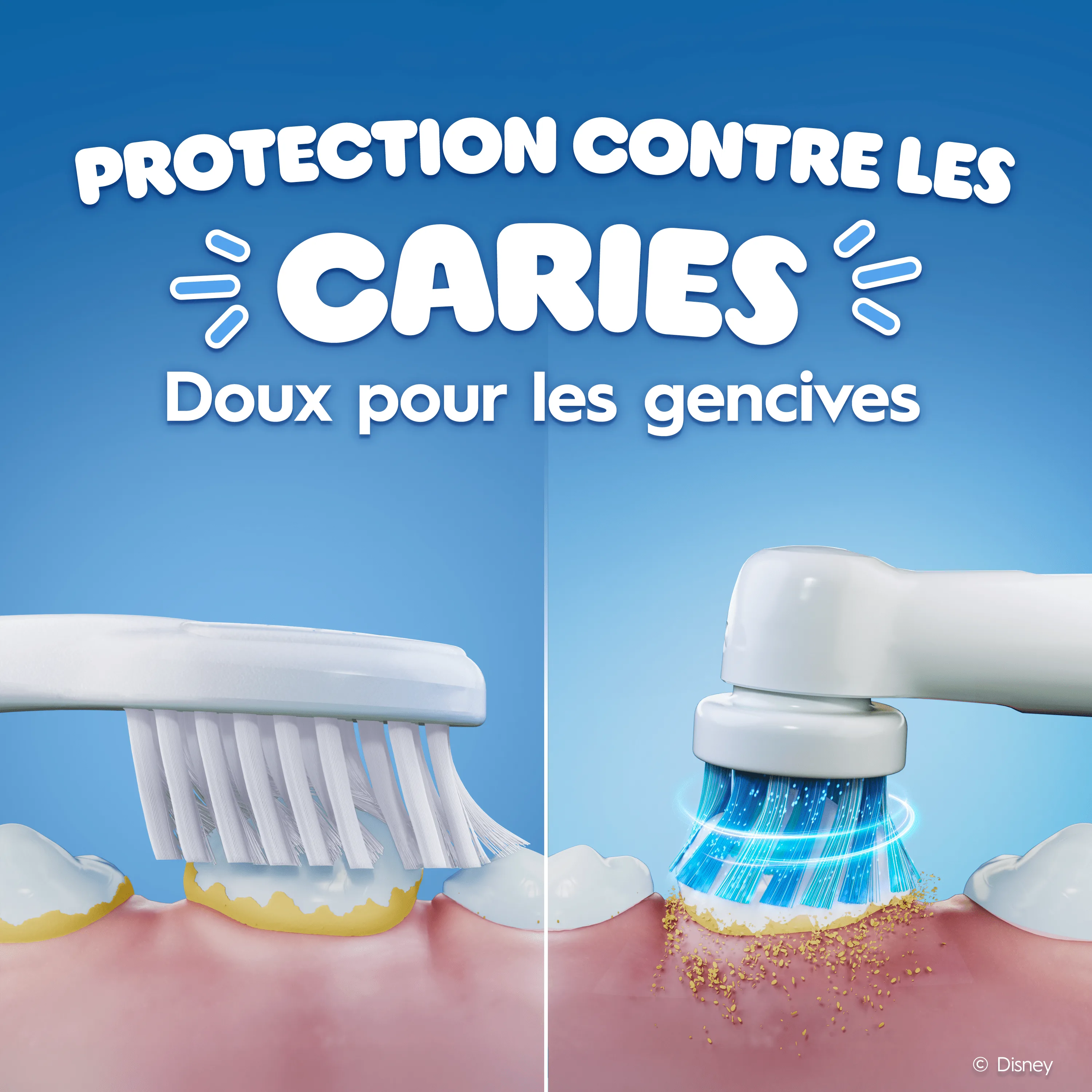 Comparaison entre une brosse à dents électrique et une manuelle pour les caries et les gencives.