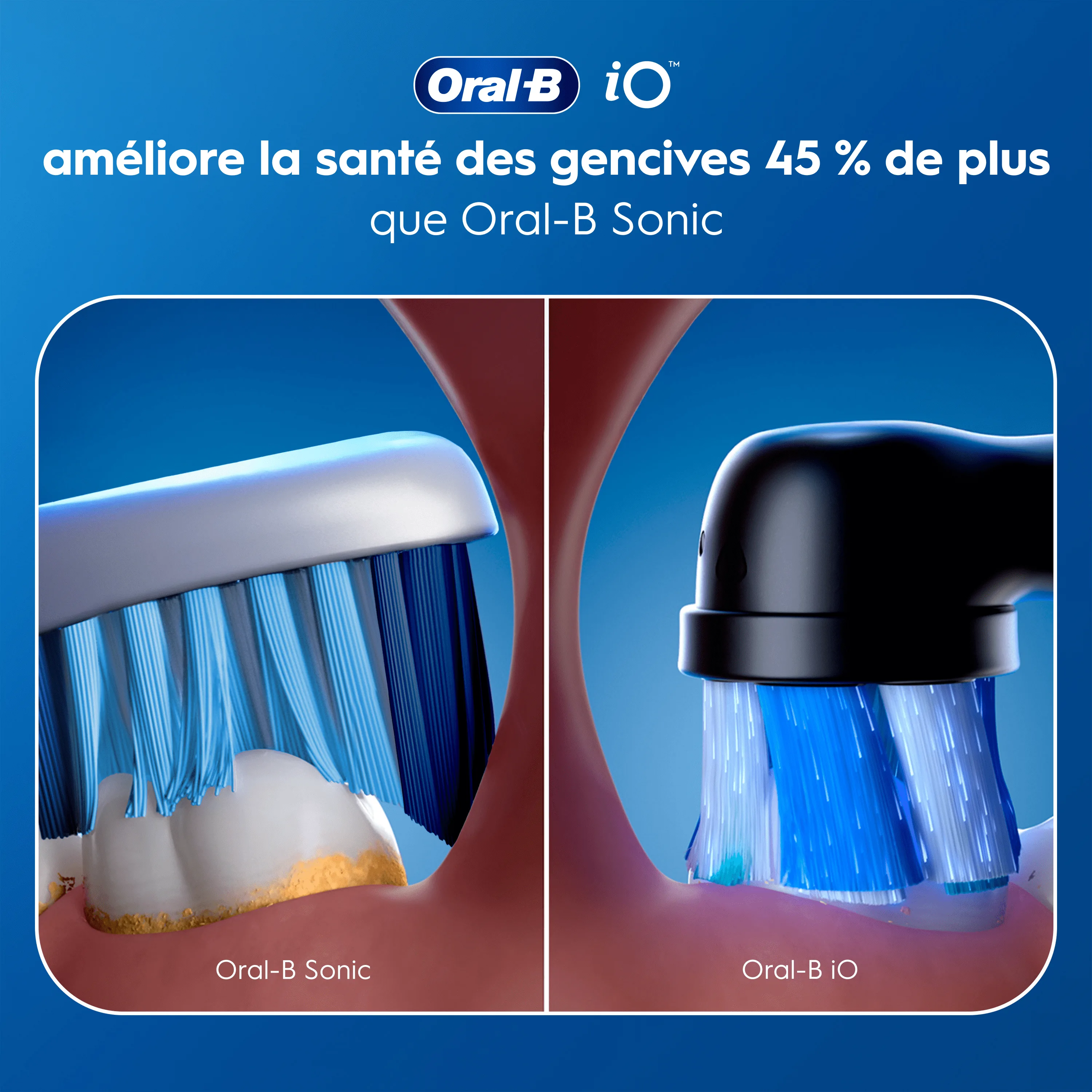 Comparaison Oral-B iO et Sonic: iO améliore la santé des gencives 45% plus, avec visualisation des têtes de brosse.