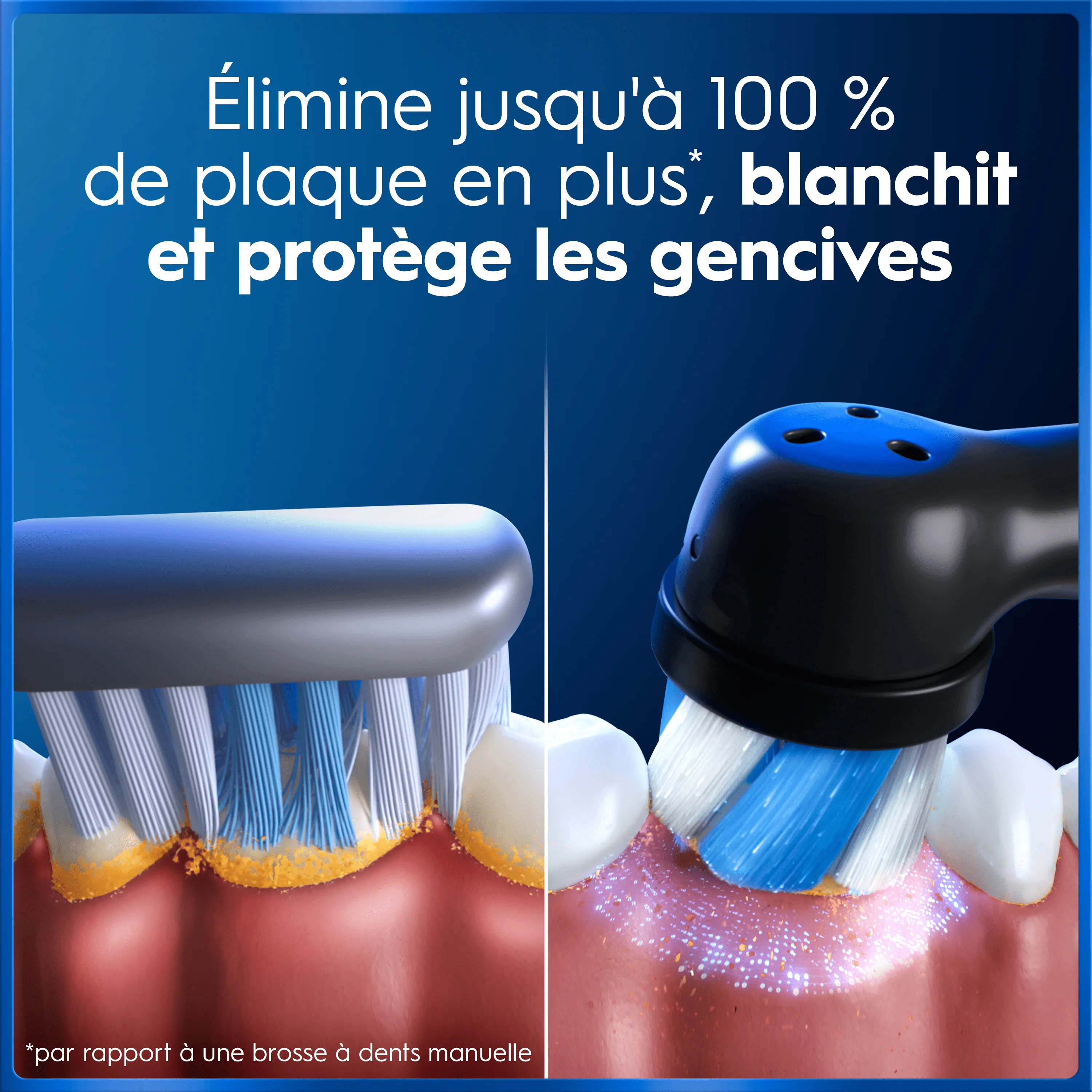 Comparaison entre brosse à dents manuelle et électrique montrant l'efficacité supérieure pour éliminer la plaque, blanchir et protéger les gencives.