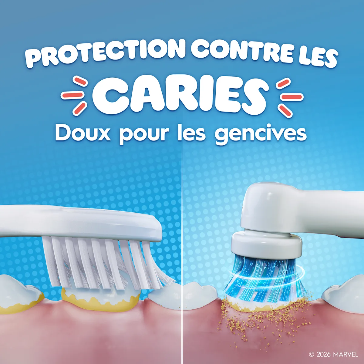 Comparaison entre une brosse à dents électrique et une manuelle pour les caries et les gencives.