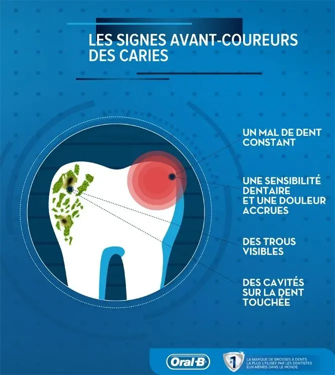 Symptômes, causes et traitement des caries