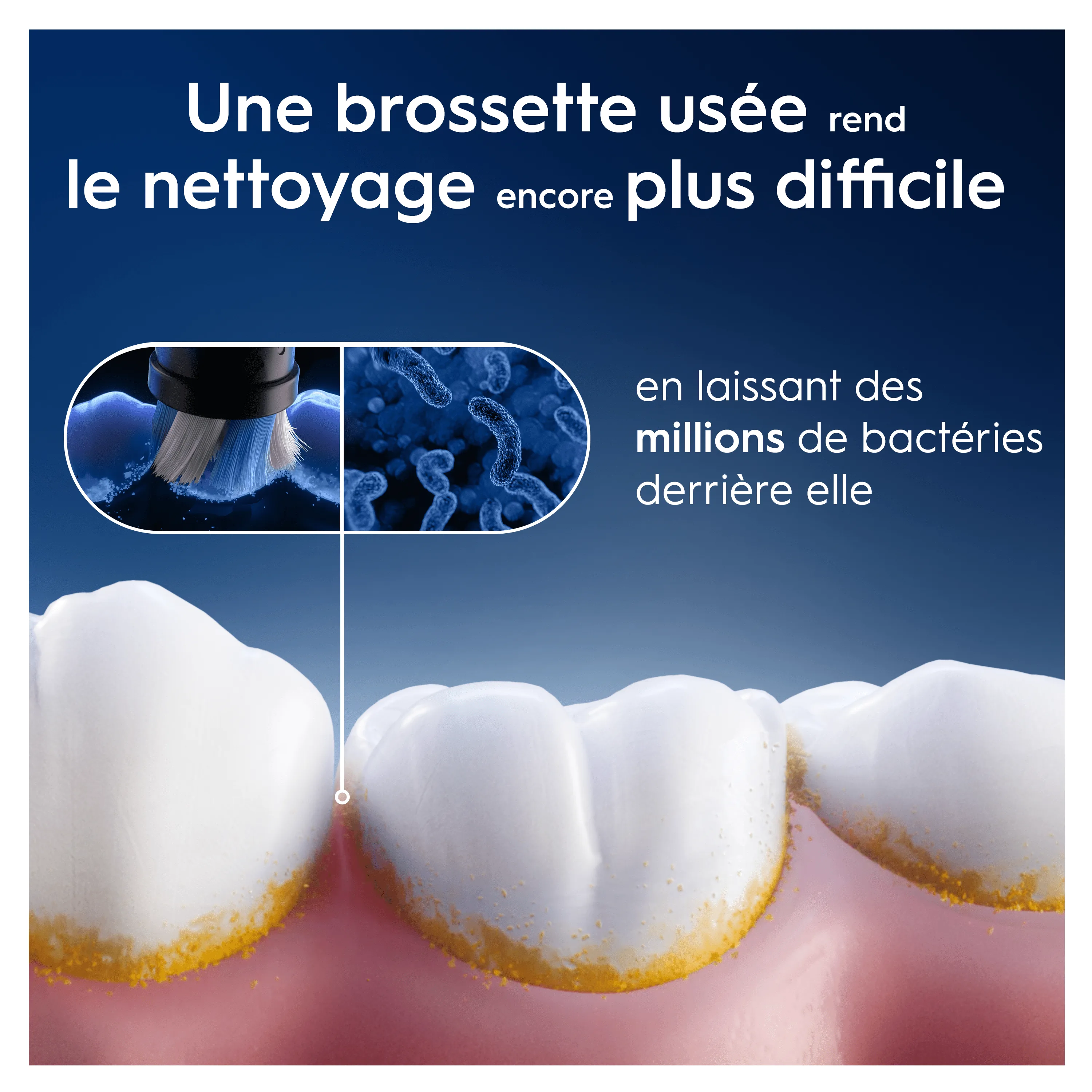Une brossette usagée laisse des millions de bactéries, rendant le nettoyage difficile, comme illustré sur les dents.