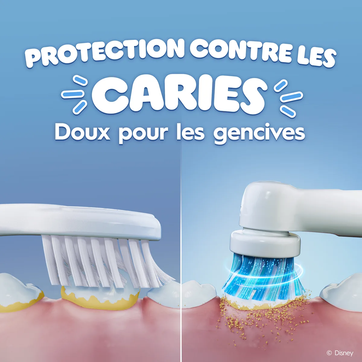 Comparaison entre une brosse à dents électrique et une manuelle pour les caries et les gencives.