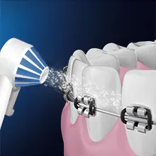 La canule AquaCare Série 4 nettoie les résidus entre les dents avec un appareil orthodontique.		 