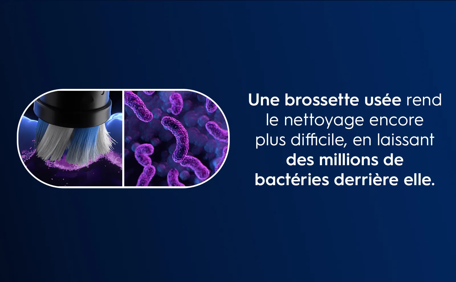 Gros plan sur les bactéries présentes sur une brossette usée qui rend le nettoyage plus difficile