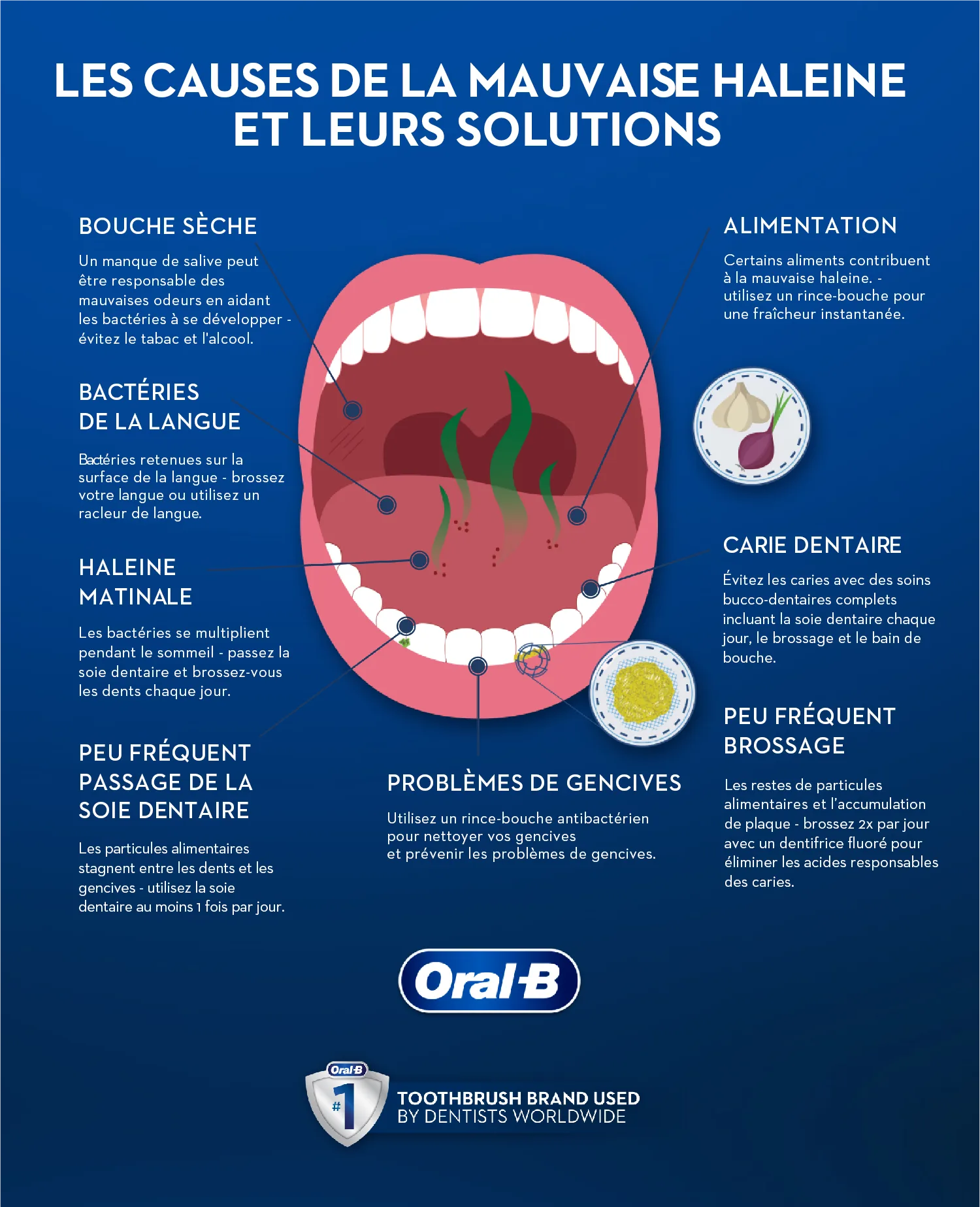Se débarrasser des causes de la mauvaise haleine (halitose)