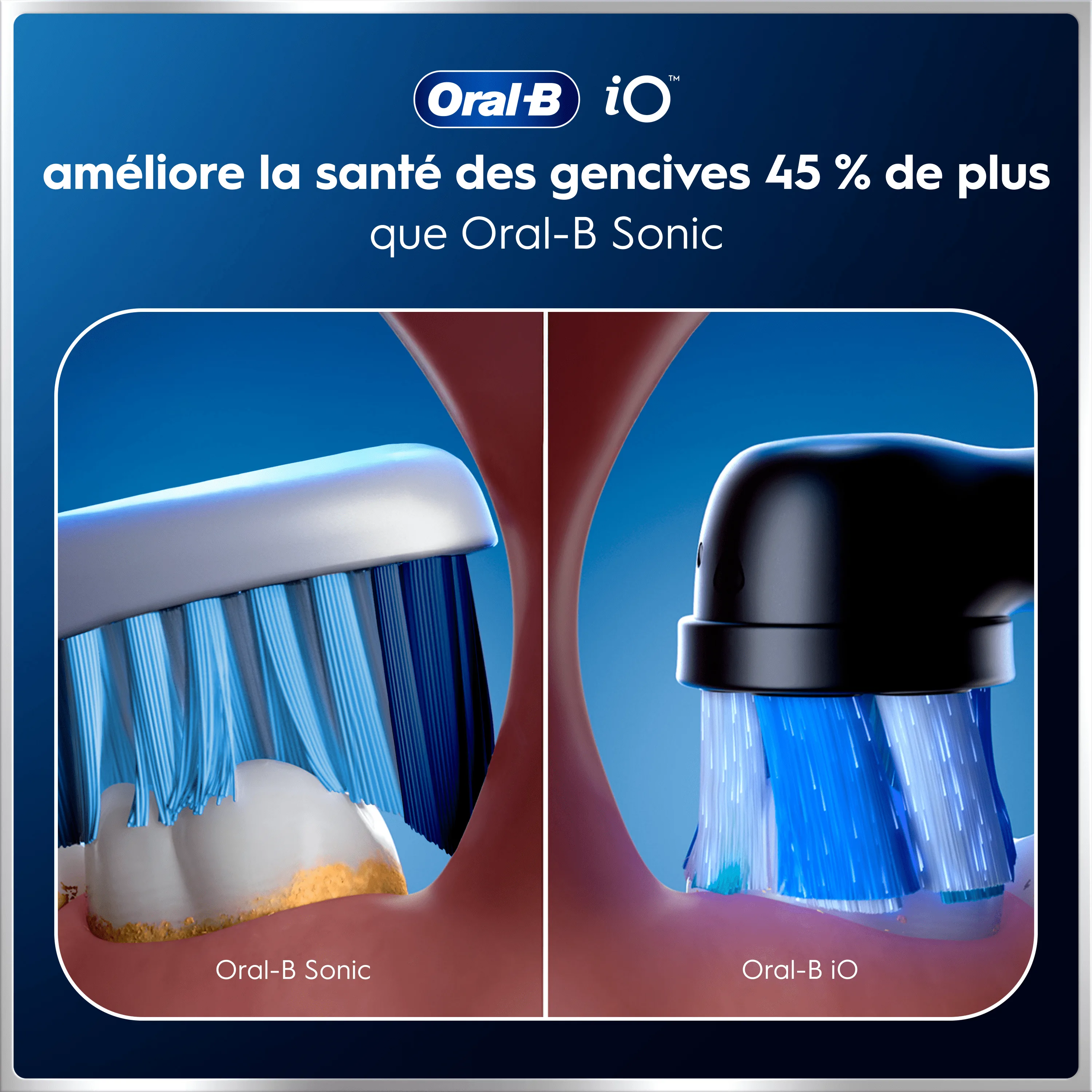 Oral-B iO améliore la santé des gencives 45% de plus que Oral-B Sonic.