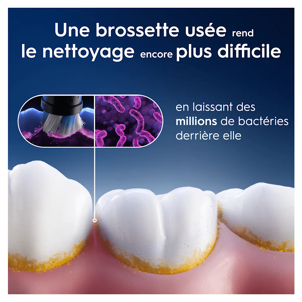 Oral-B : Une brossette usée rend le nettoyage plus difficile, laissant des millions de bactéries.