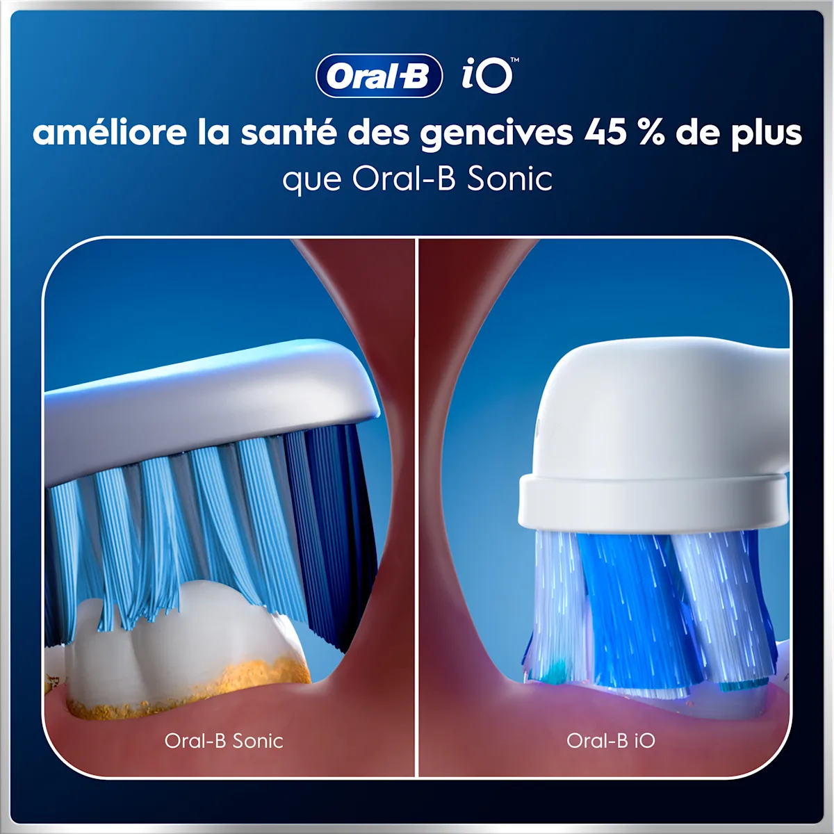 Comparaison entre brosse à dents manuelle et Oral-B iO pour un nettoyage plus efficace des dents et des gencives.