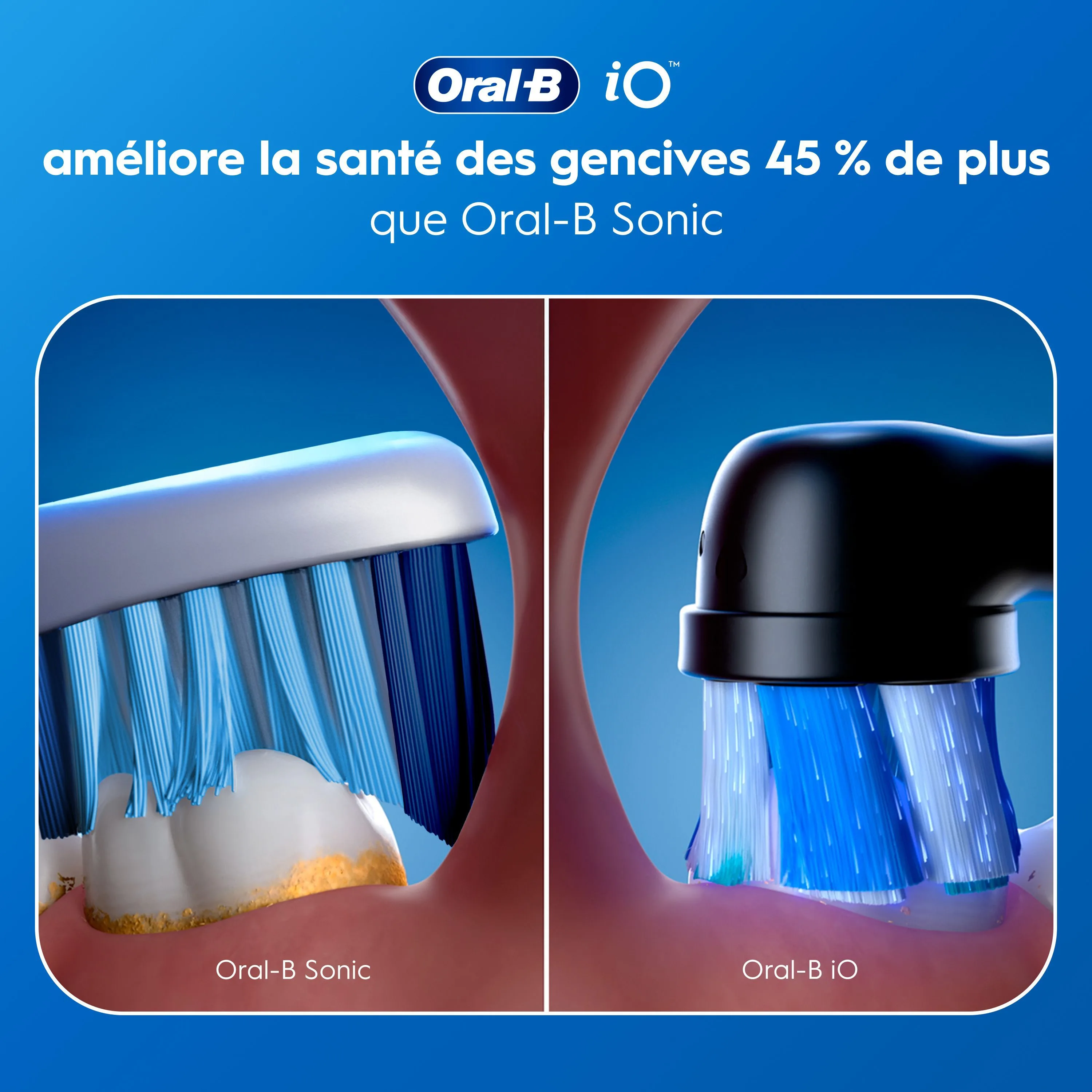 Oral-B iO améliore la santé des gencives 45% de plus qu’Oral-B Sonic.
