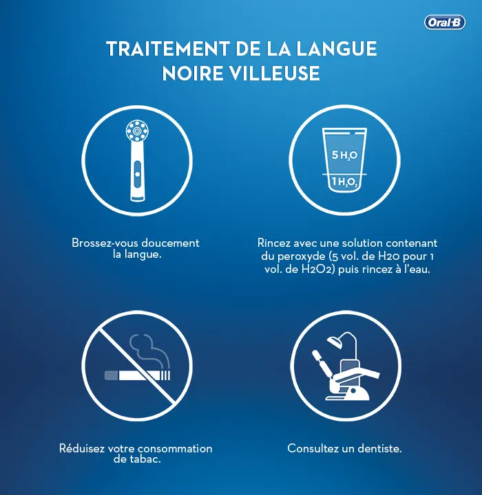 image - Langue noire et villeuse: causes, symptômes et traitements - 02