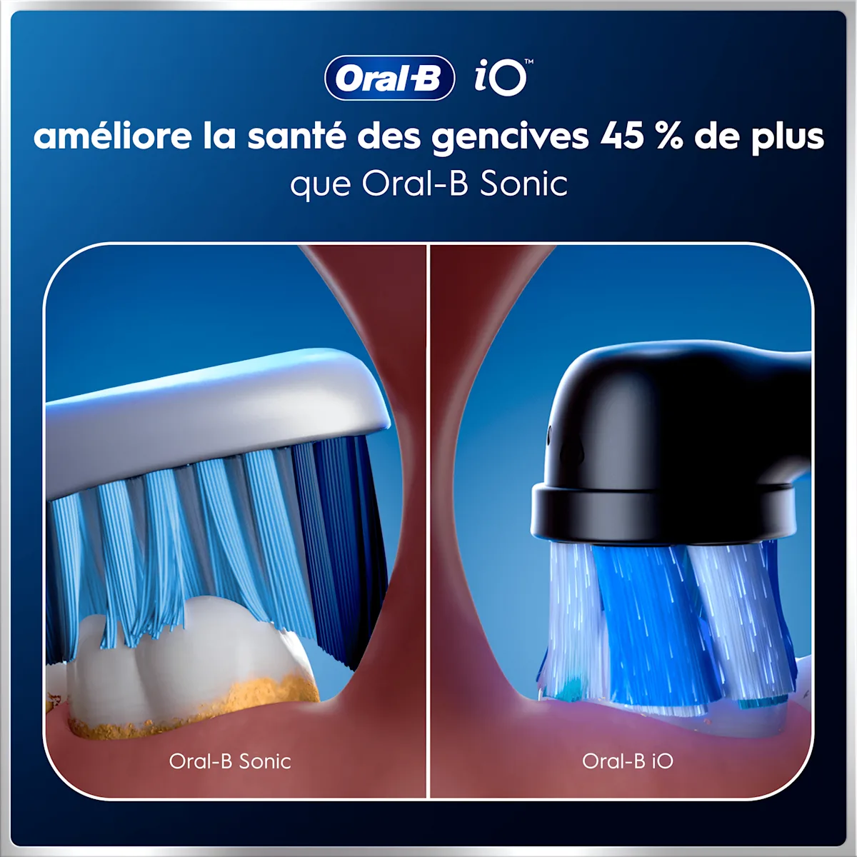 Oral-B iO améliore la santé des gencives 45% de plus que Oral-B Sonic.