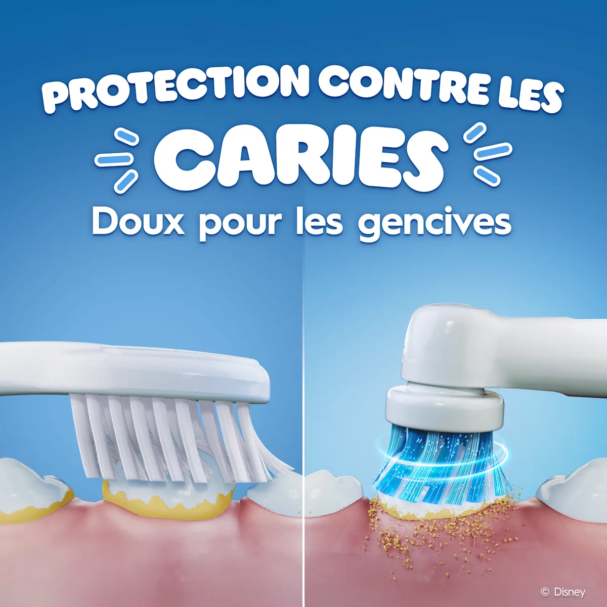 Comparaison entre une brosse à dents électrique et une manuelle pour les caries et les gencives.