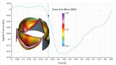 The heart of the matter: best practices for modeling two-way Fluid-Structure Interaction in human heart valves