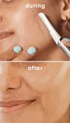 Facial Hair & Skin Dermaplane razor Usage During and After